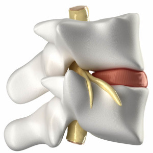 Vertebra, intervertebral disc and spinal cord